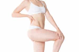 Liposuction fat and cellulite removal concept