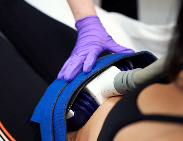 coolsculpting procedure