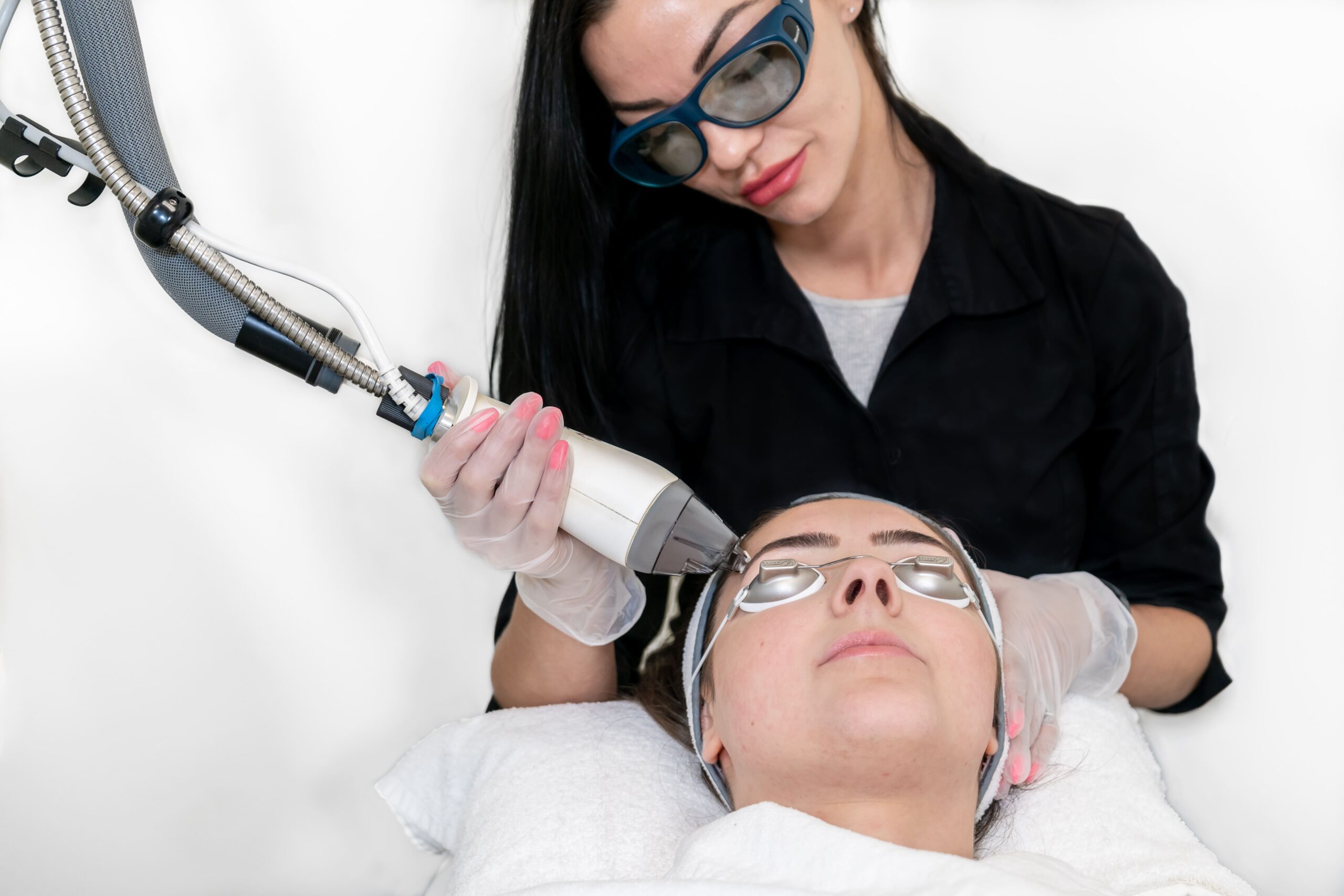 CO2 Laser Treatment