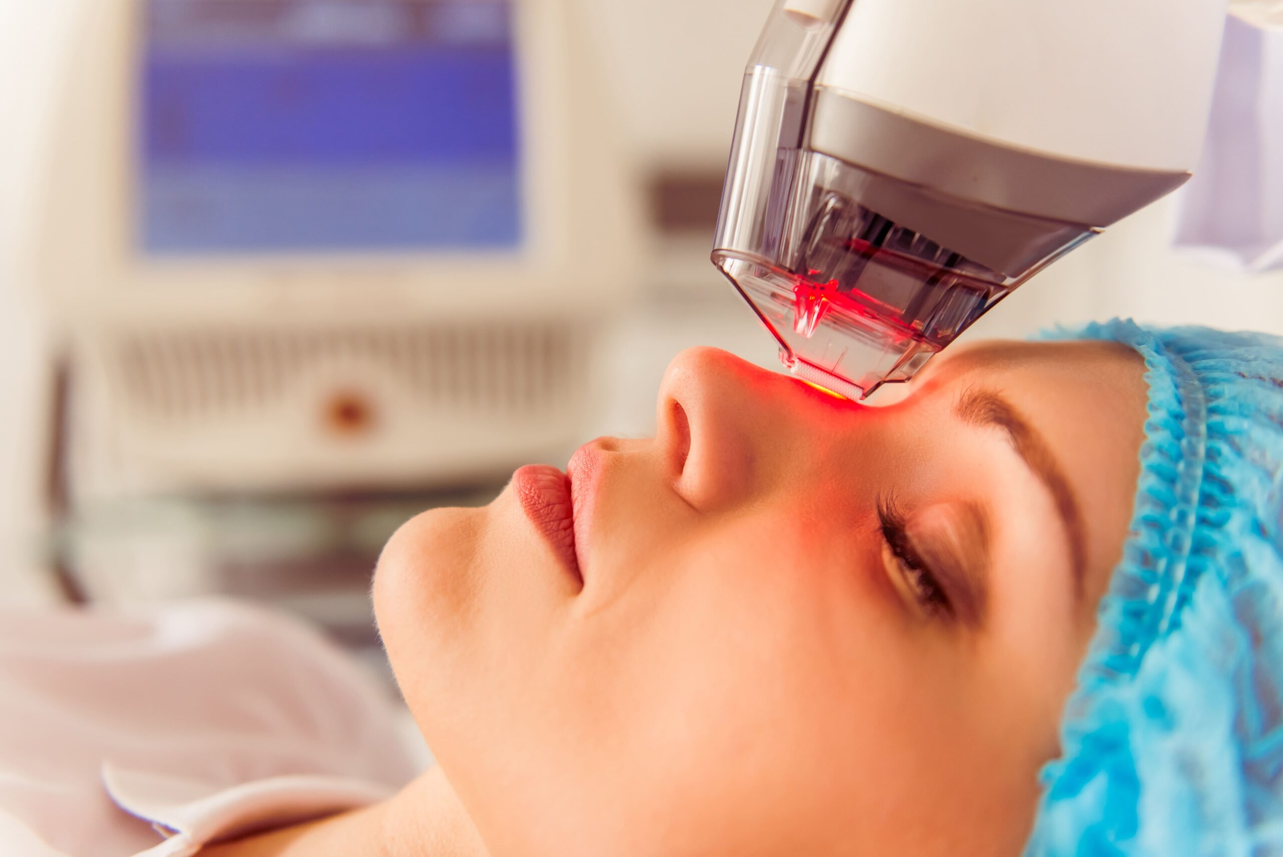 Radiofrequency Microneedling