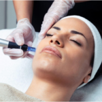 Microneedling new one