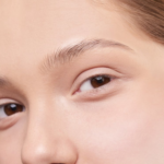 Blepharoplasty feature